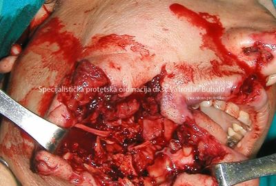 Most Demanding Cases 1