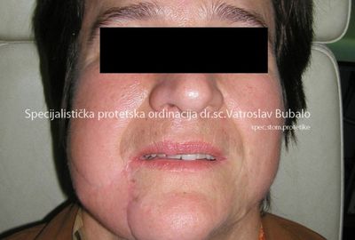 Most Demanding Cases 2