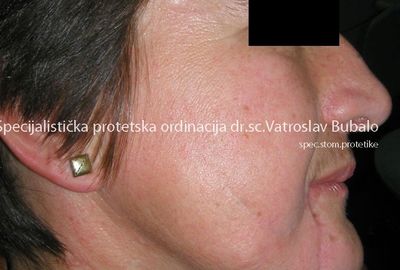 Most Demanding Cases 3