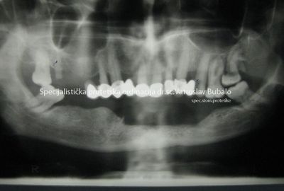 Most Demanding Cases 4