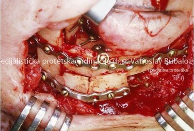 Most Demanding Cases 5