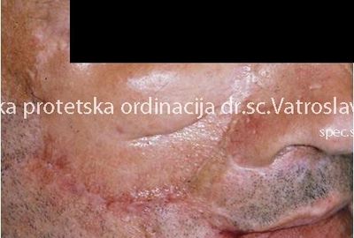 Most Demanding Cases 6